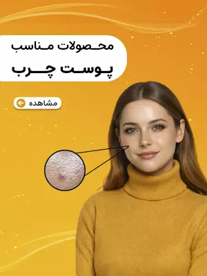 پوست چرب